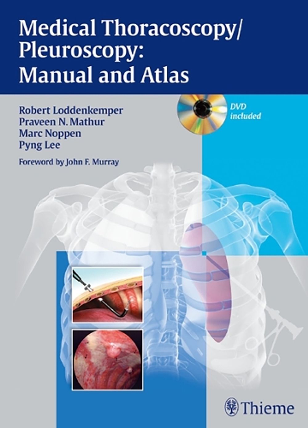 Medical Thoracoscopy / Pleuroscopy: Manual and Atlas by Robert Loddenkemper - ISBN: 9783131082213