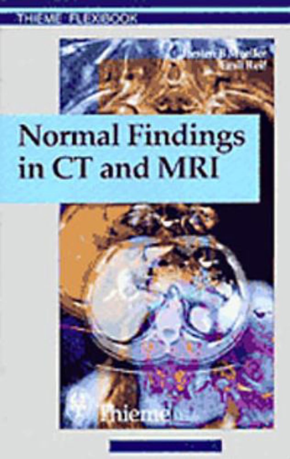 normal-findings-in-ct-and-mri-a1-print-by-therald-moeller-paperback