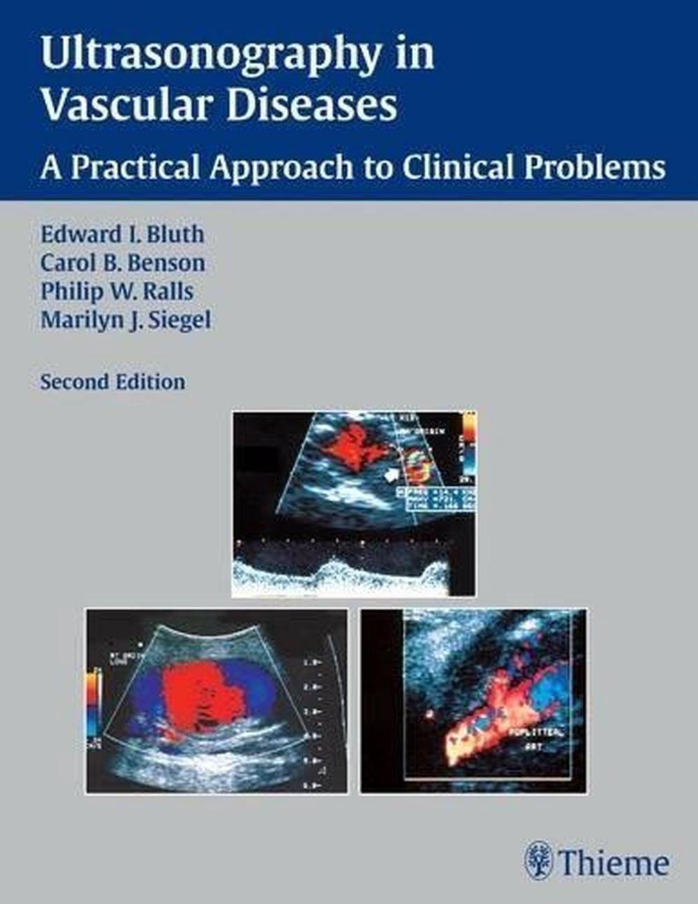 Ultrasonography in Vascular Diseases by Edward I. Bluth - ISBN: 9783131291424