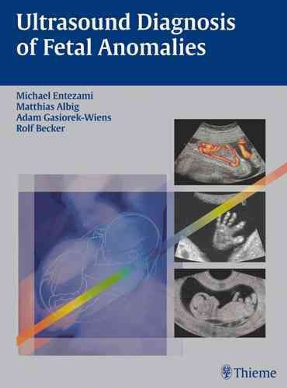 Ultrasound Diagnosis of Fetal Anomalies by Michael Entezami - ISBN: 9783131318619