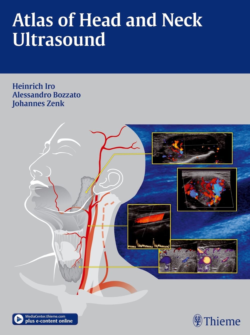 Atlas of Head and Neck Ultrasound by Heinrich Iro - ISBN: 9783131603517