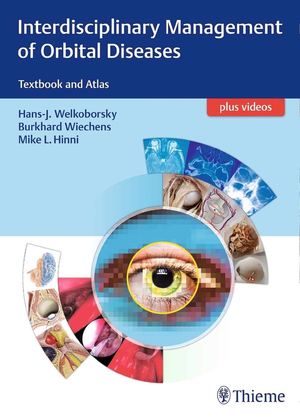 Interdisciplinary Management of Orbital Diseases by Burkhard Wiechens - ISBN: 9783131994219