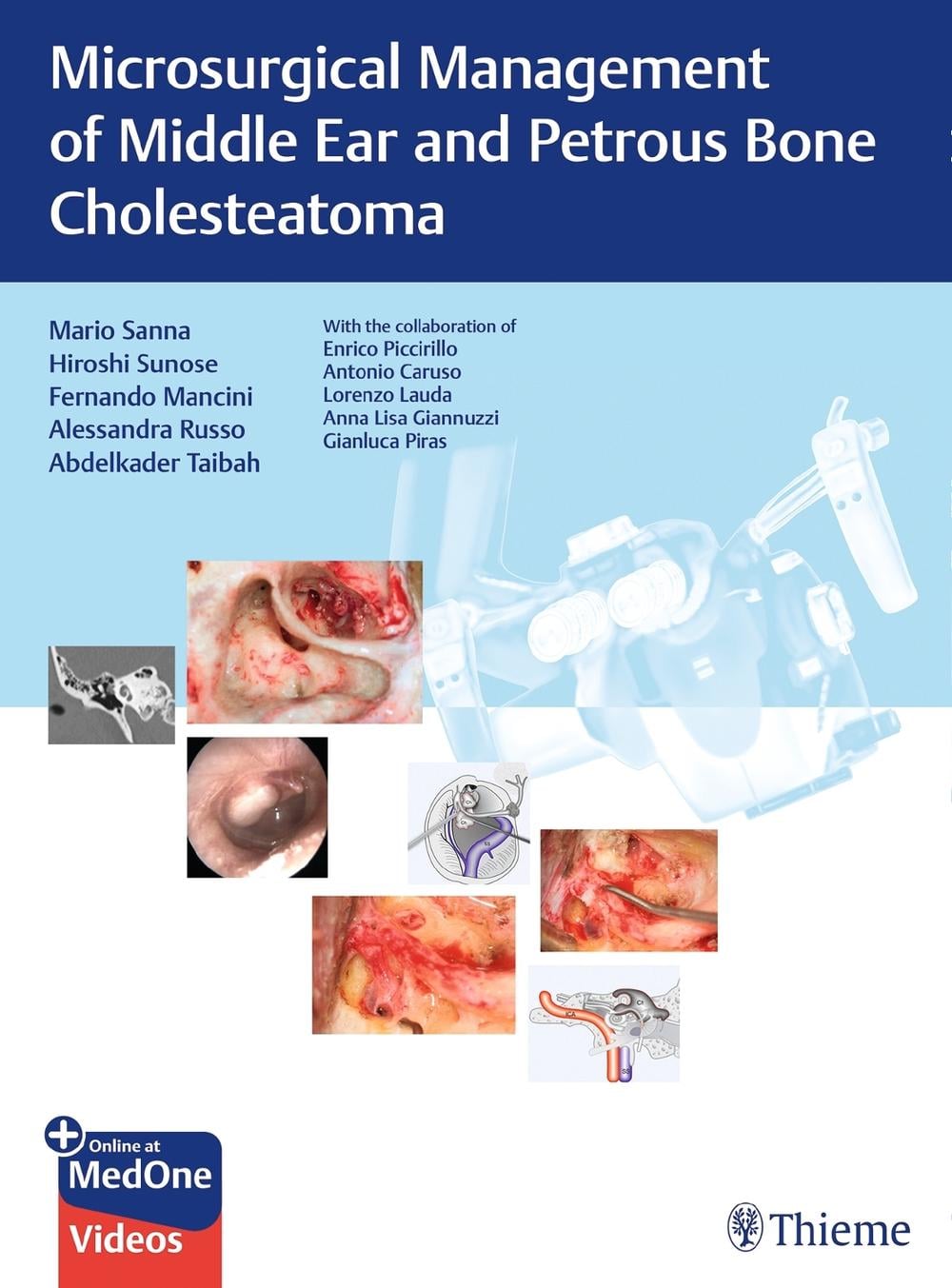 Microsurgical Management of Middle Ear and Petrous Bone Cholesteatoma by Mario Sanna - ISBN: 9783132000056