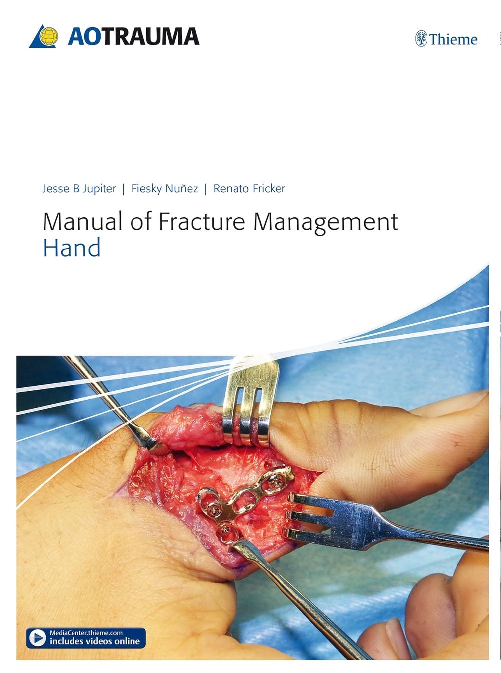 Manual of Fracture Management - Hand by Jesse B. Jupiter - ISBN: 9783132215818