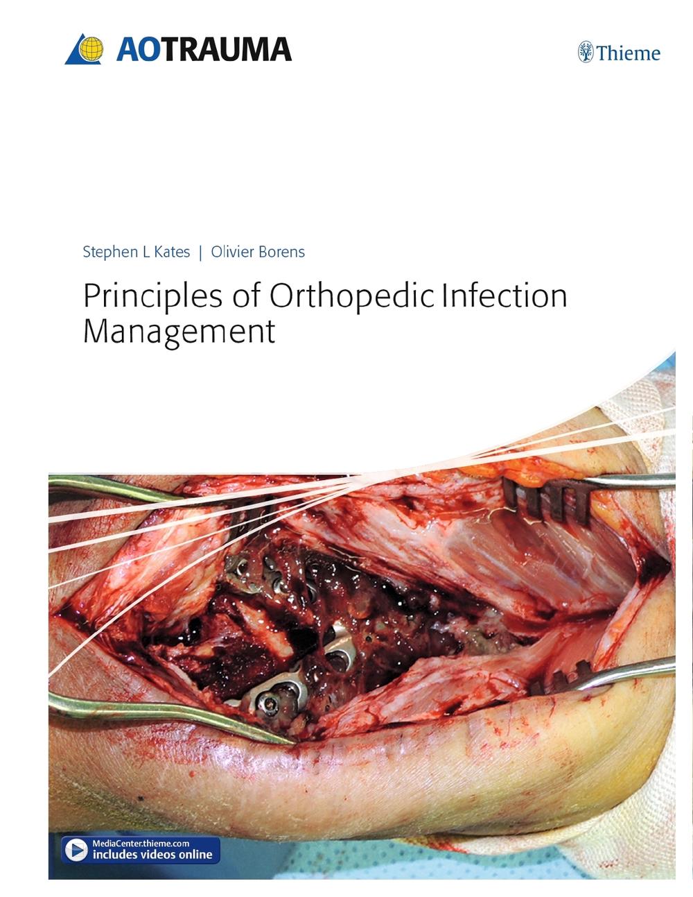 Principles of Orthopedic Infection Management by Olivier Borens - ISBN: 9783132410756