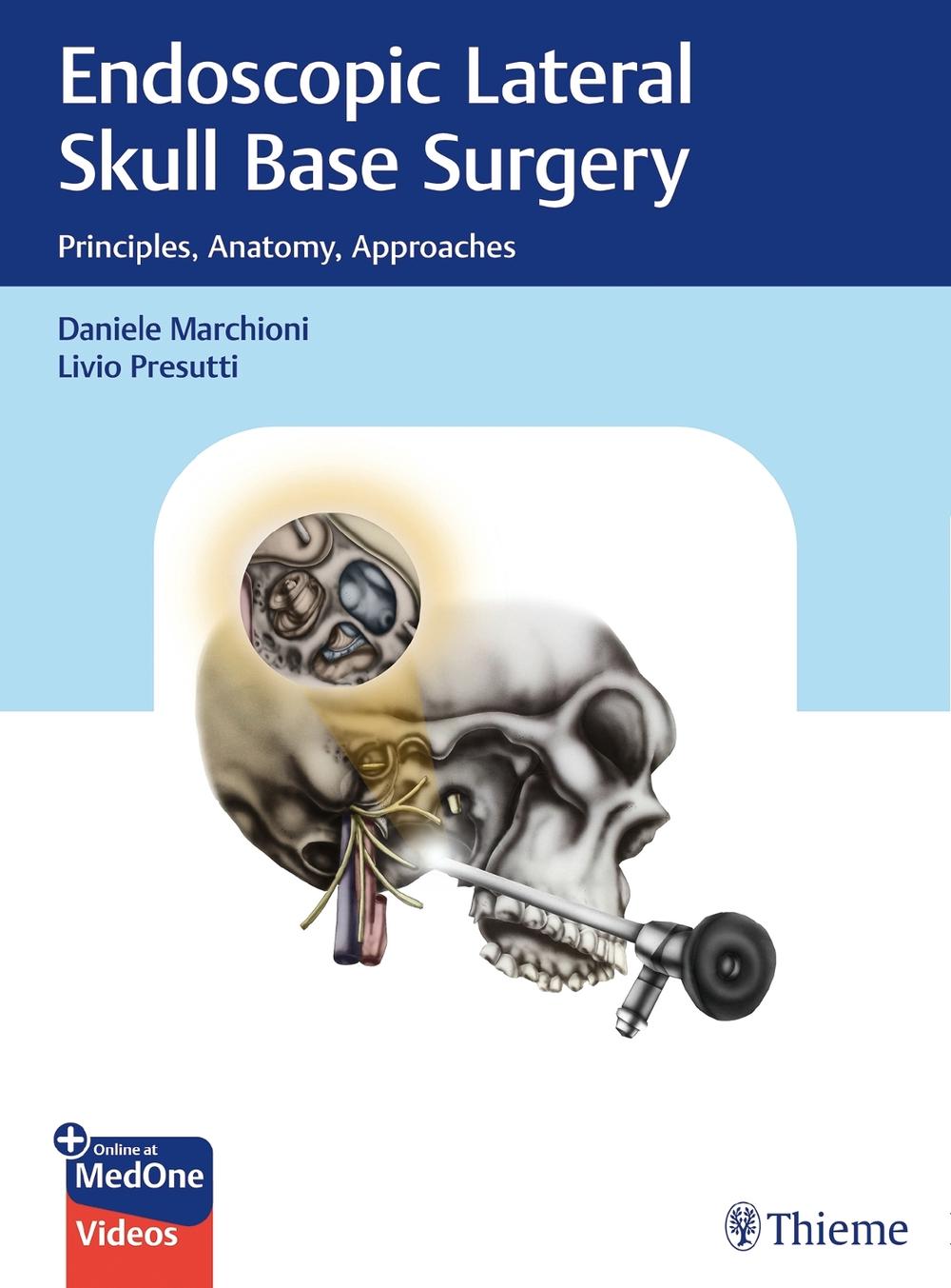 Endoscopic Lateral Skull Base Surgery, 9783132412774
