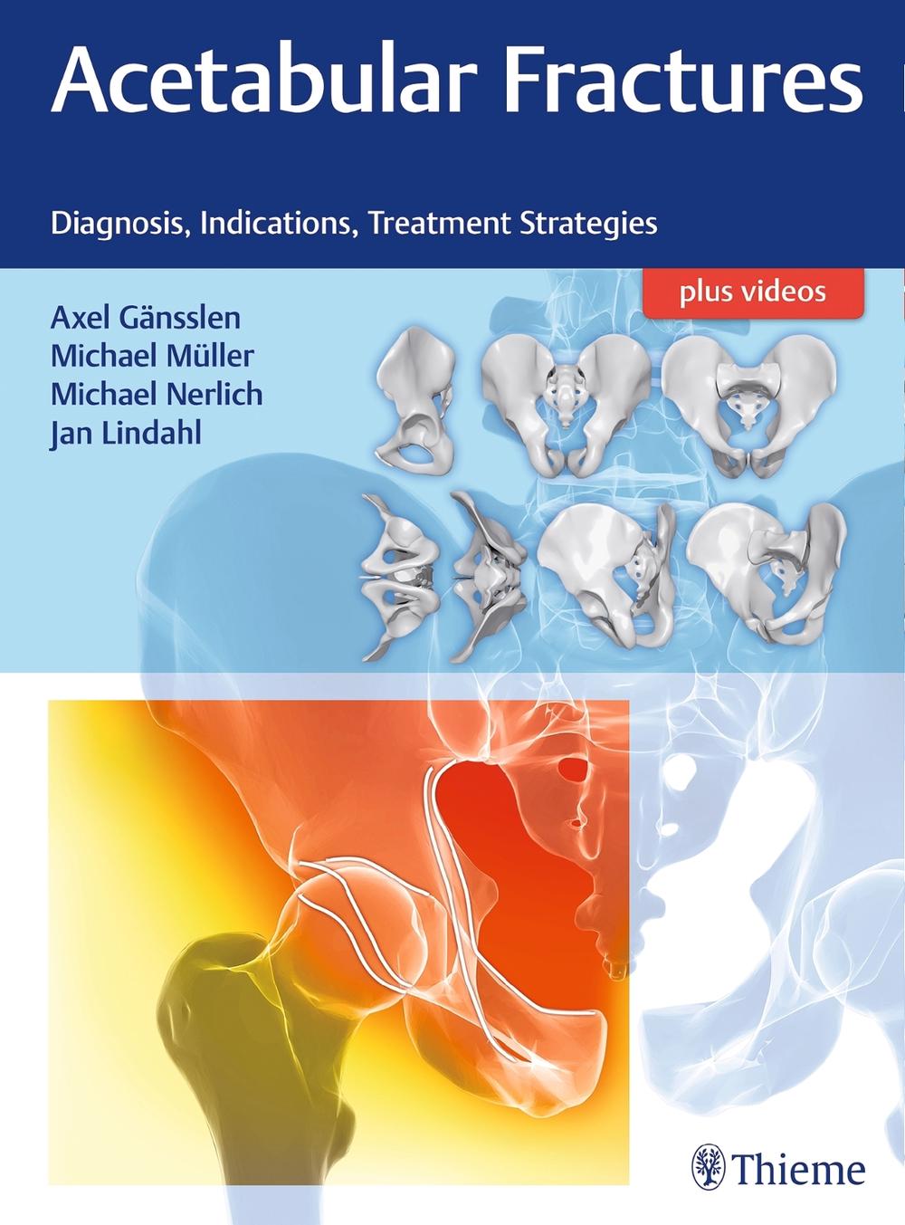 Acetabular Fractures by Michael Nerlich - ISBN: 9783132415607