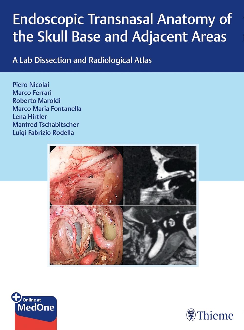 Endoscopic Transnasal Anatomy of the Skull Base and Adjacent Areas by Piero Nicolai - ISBN: 9783132415621