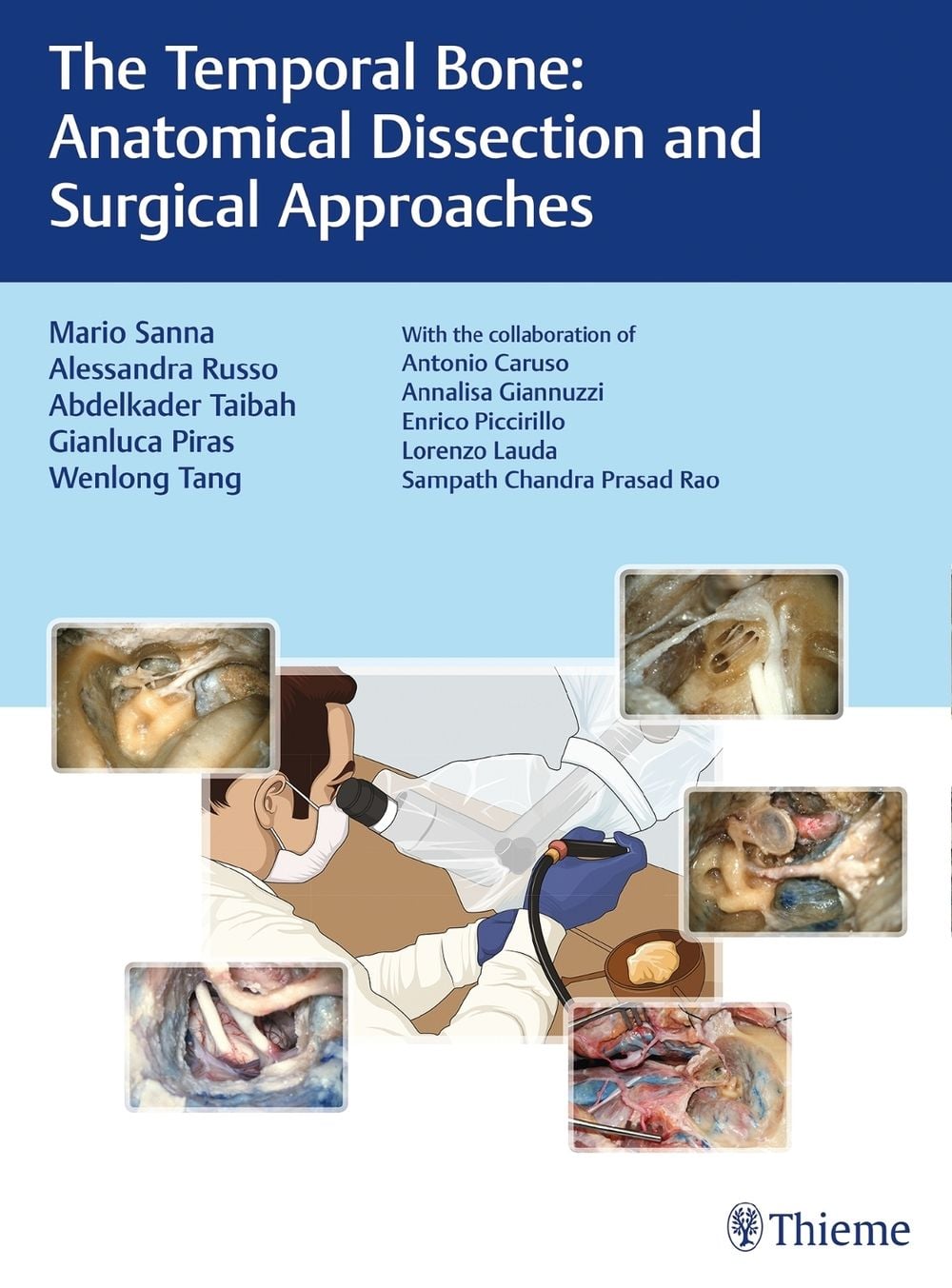 The Temporal Bone by Mario Sanna - ISBN: 9783132419346