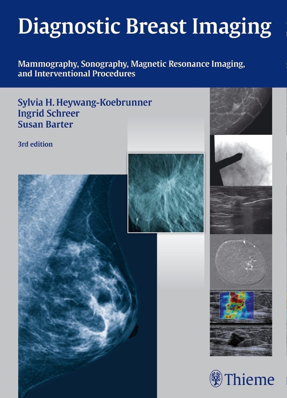 Diagnostic Breast Imaging by Ingrid Schreer - ISBN: 9783132431928