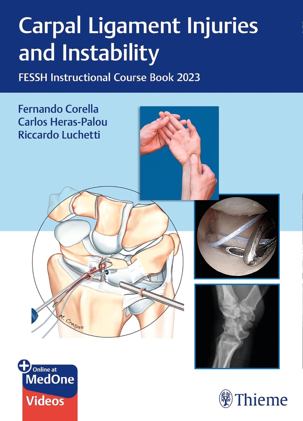 Carpal Ligament Injuries and Instability by Carlos Heras-Palou - ISBN: 9783132451896