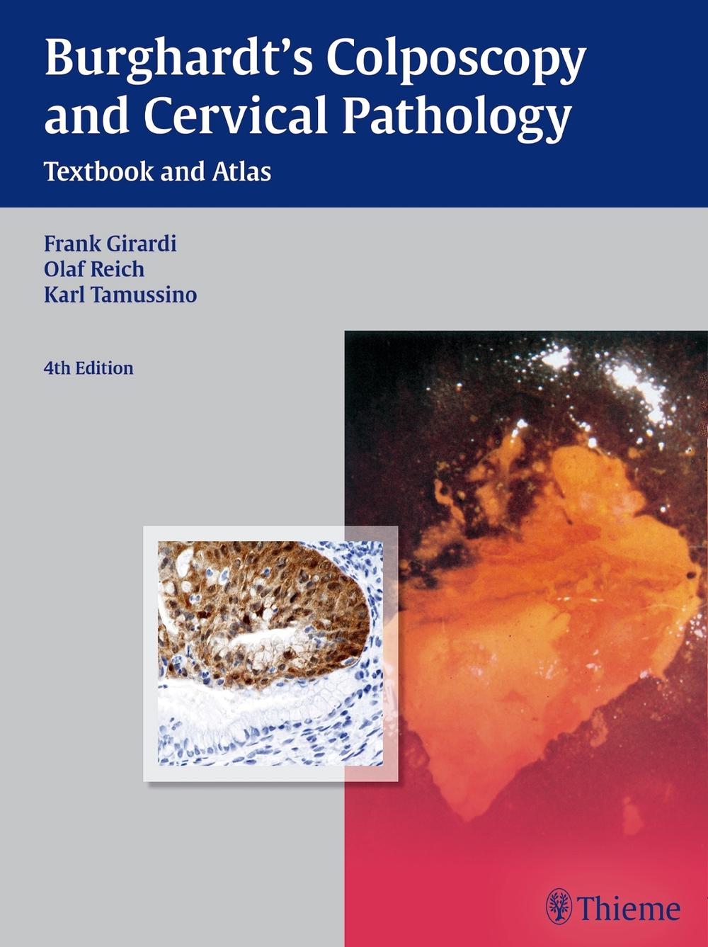Burghardt's Colposcopy and Cervical Pathology by Frank Girardi - ISBN: 9783136599044