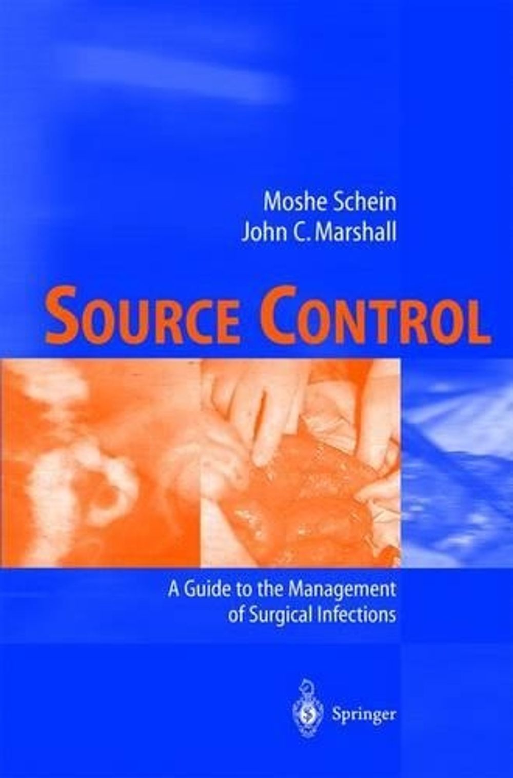 Source Control, 2003rd Edition by Moshe Schein - ISBN: 9783540429739