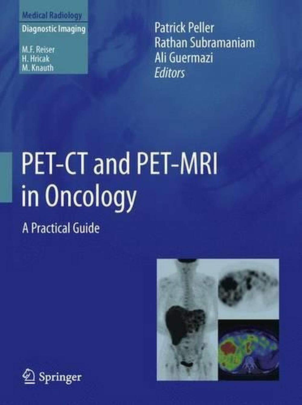 PET-CT and PET-MRI in Oncology by Patrick Peller, Hardcover ...