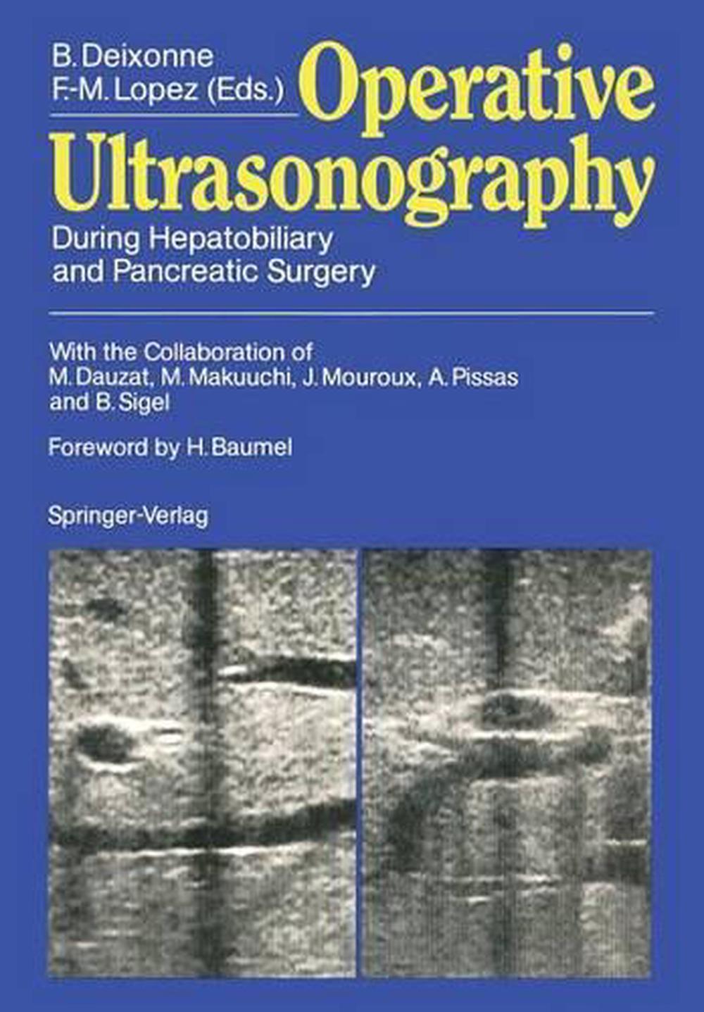 Operative Ultrasonography, 9783642955242