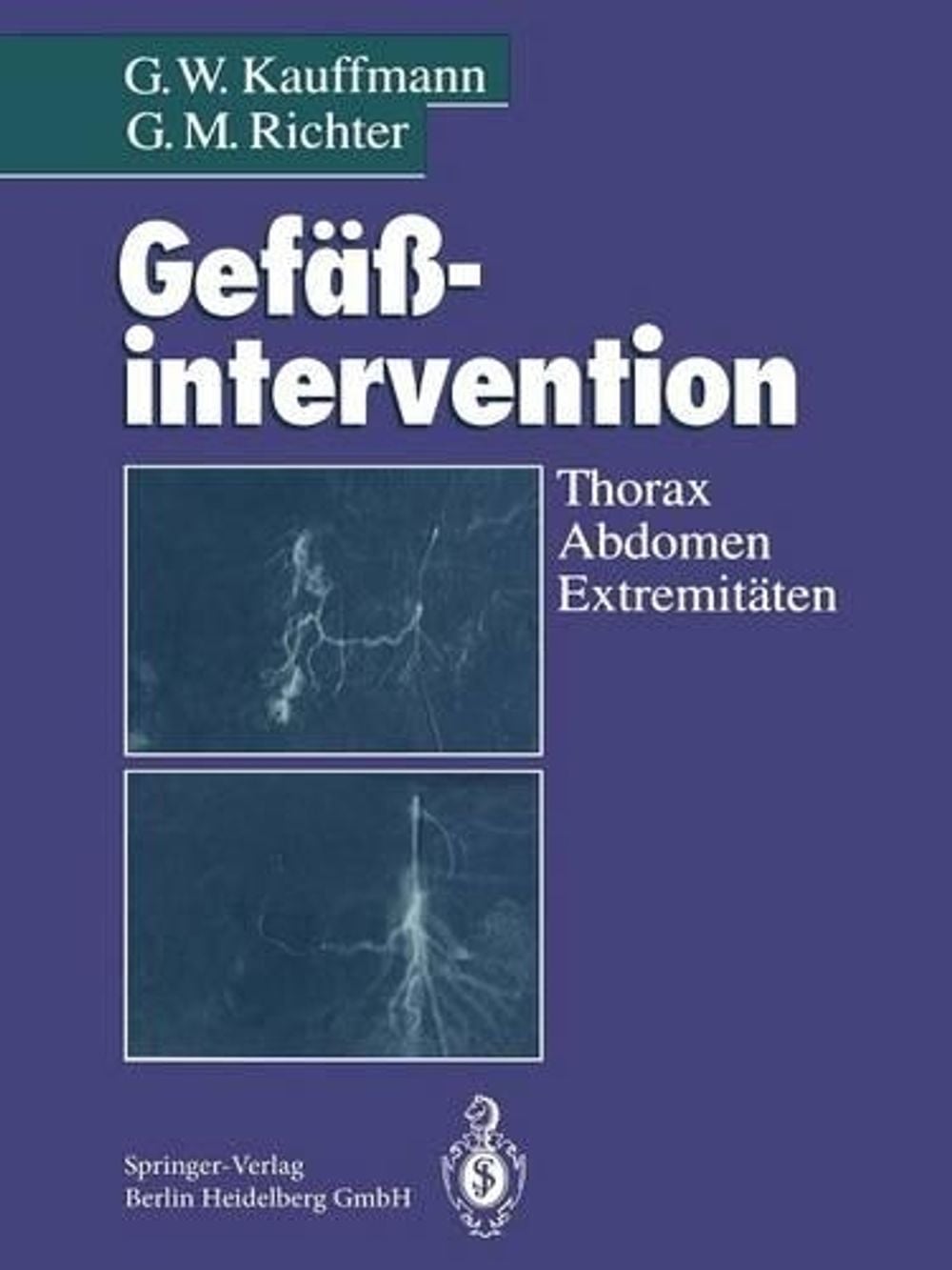 Gefäßintervention by G.W. Kauffmann - ISBN: 9783662073995