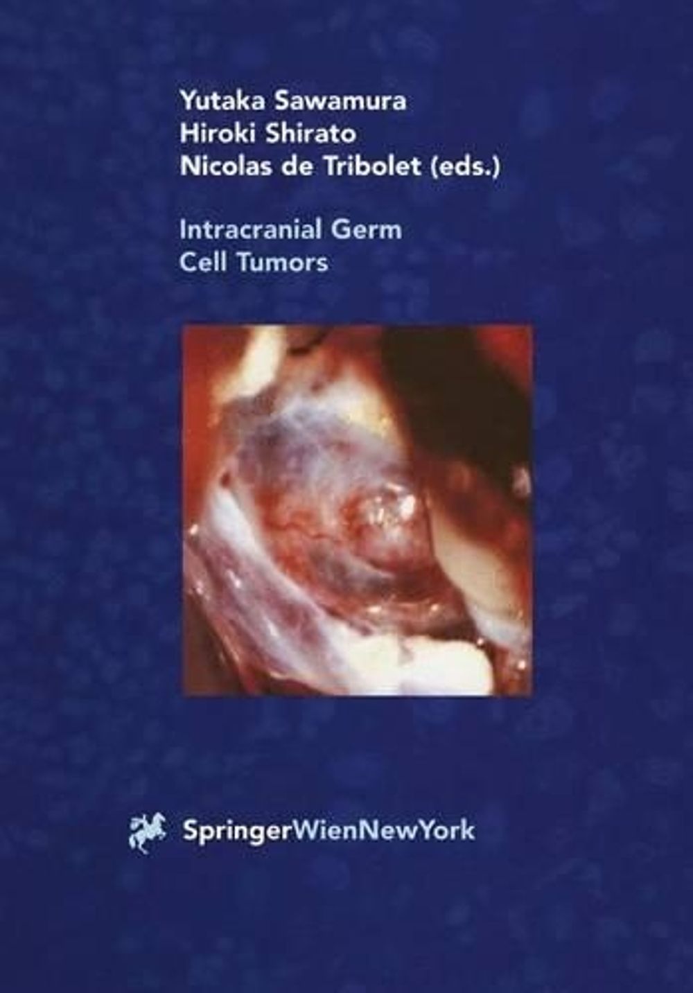 Intracranial Germ Cell Tumors by Yutaka Sawamura, Paperback ...