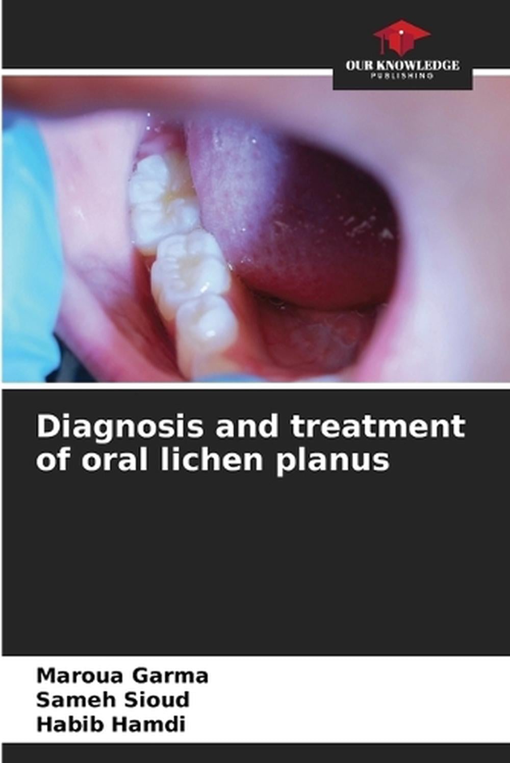 Diagnosis and treatment of oral lichen planus by Maroua Garma - ISBN: 9786208259785