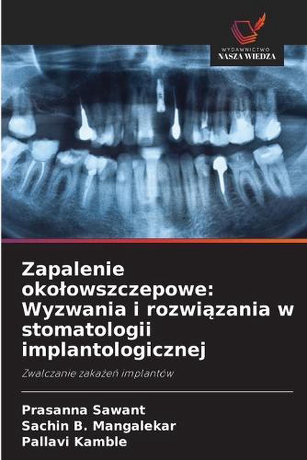 Zapalenie okolowszczepowe, 9786208611590