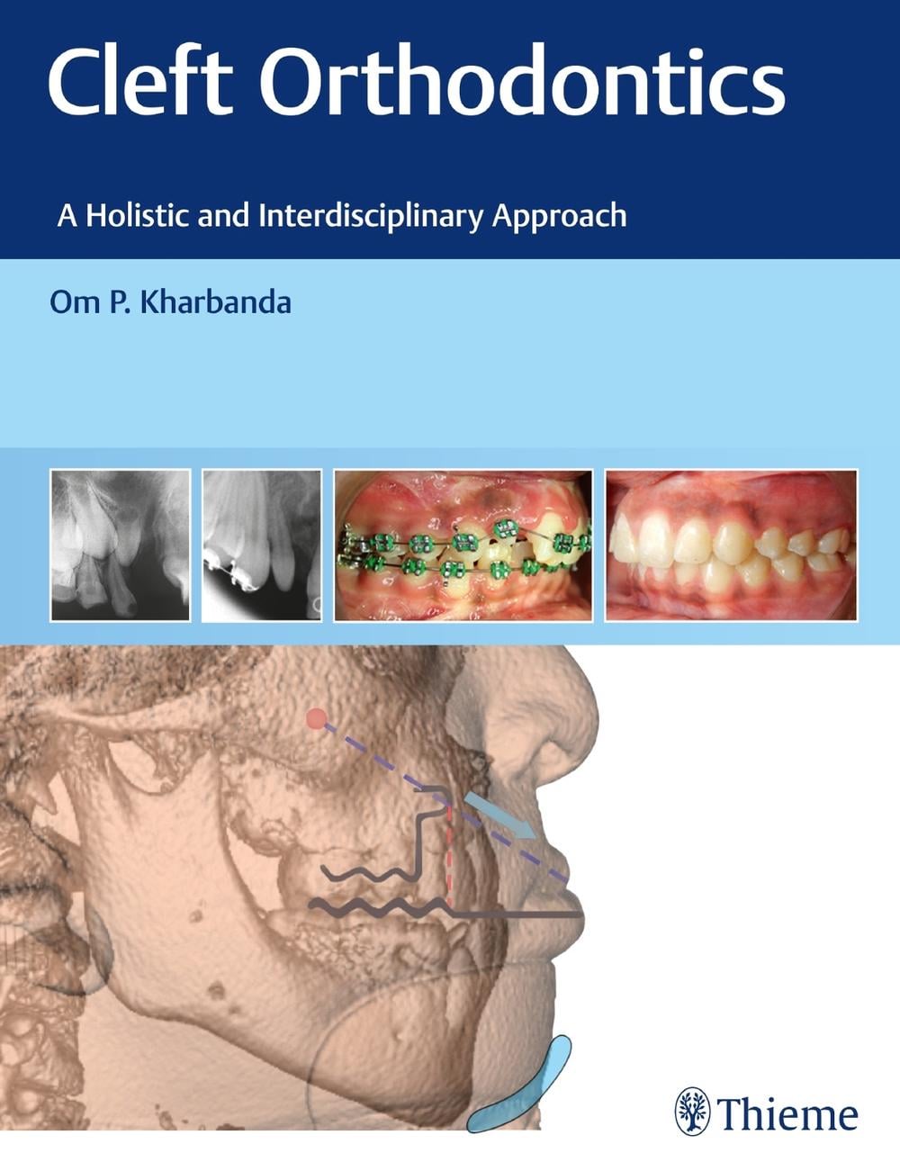 Cleft Orthodontics by Om P. Kharbanda - ISBN: 9788194857082