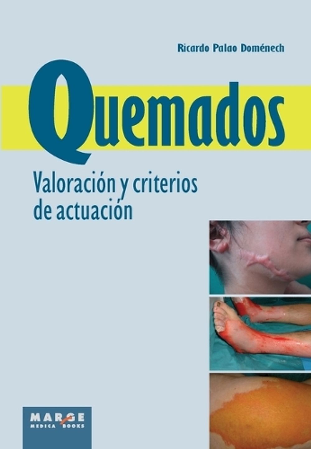 Quemados. Valoración y criterios de actuación by Ricardo Palao Doménech - ISBN: 9788415340140