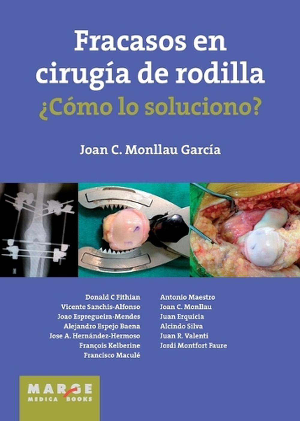 Fracasos en cirugía de rodilla ¿Cómo lo soluciono? by Juan C. Monllau García - ISBN: 9788416171118