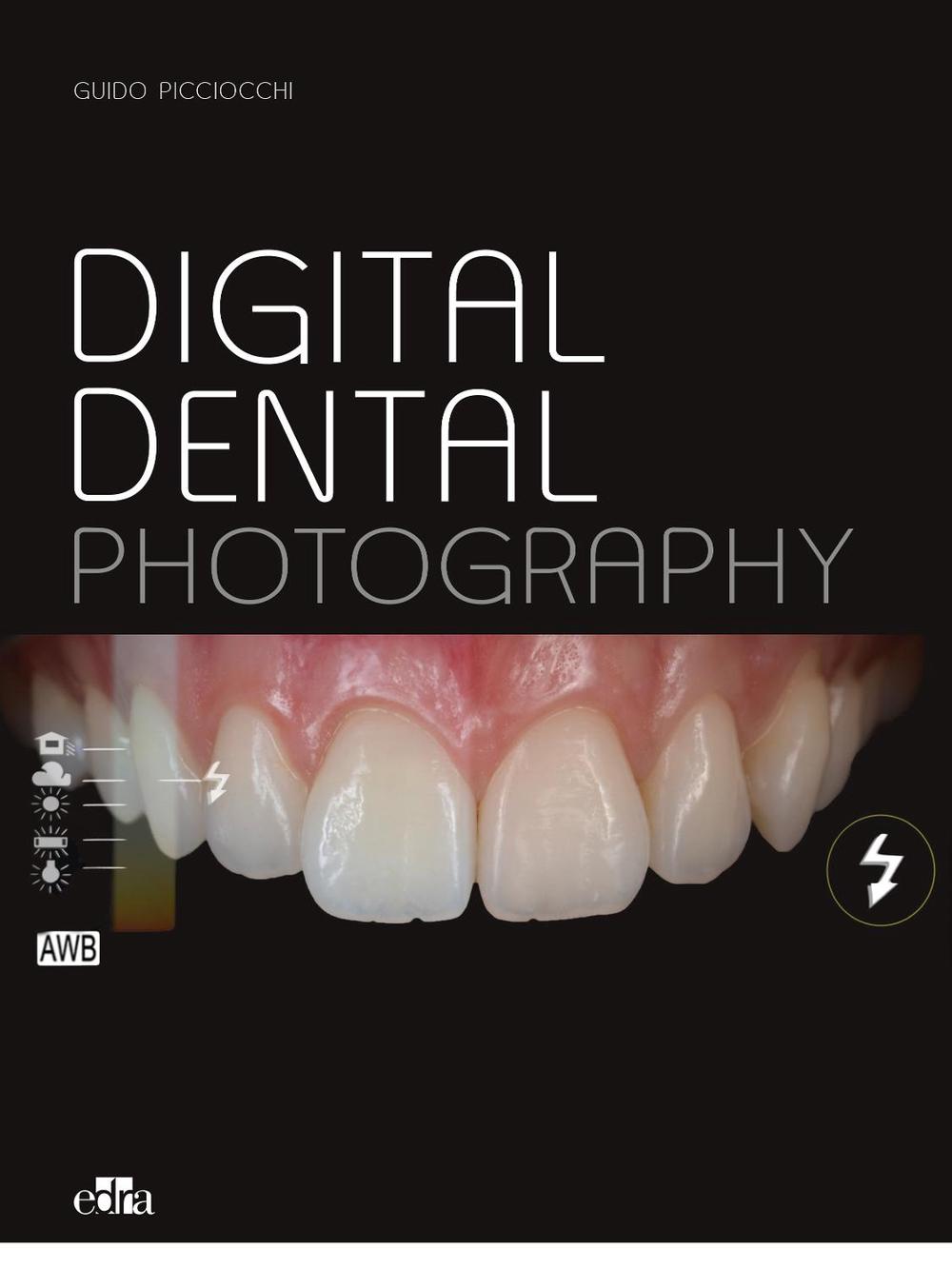 Esthetic Implants -How to think about complex cases in anterior - areas with a global approach to the patient smile (2 books), 9788821453267