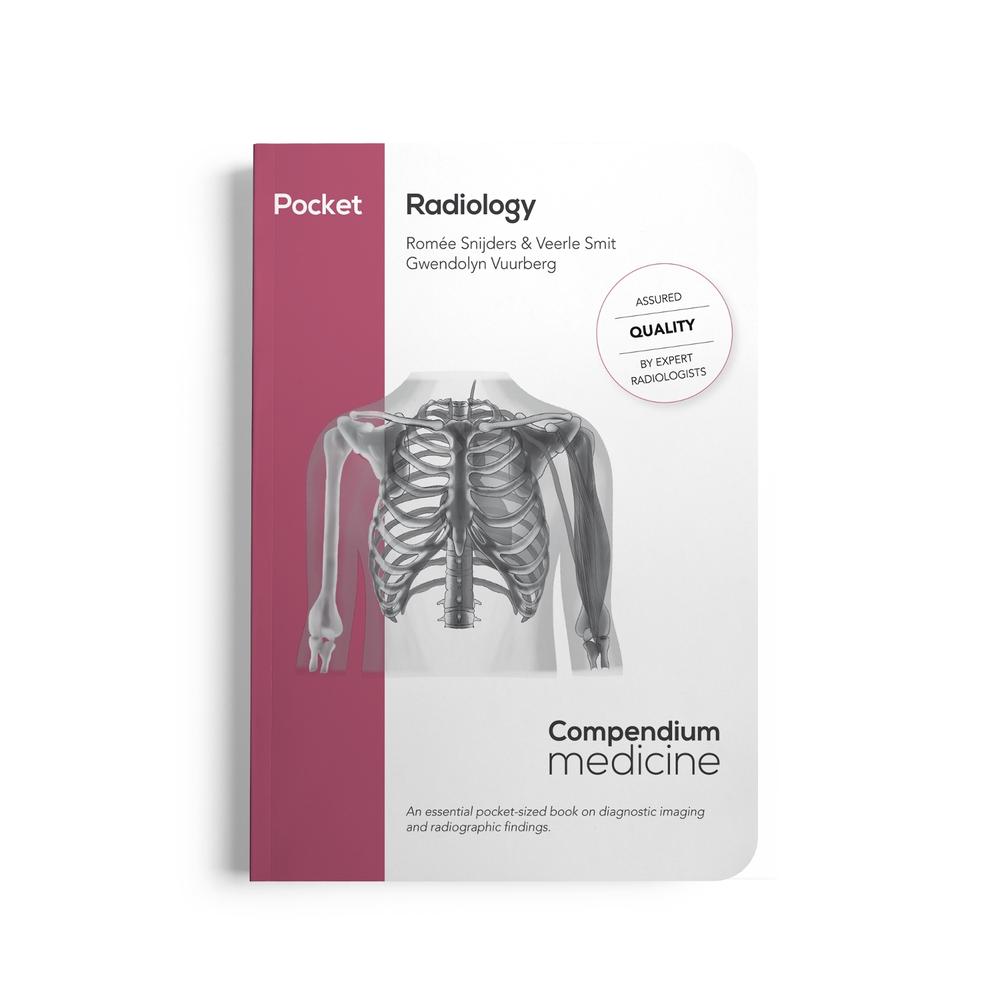 Pocket Radiology, 9789083190983