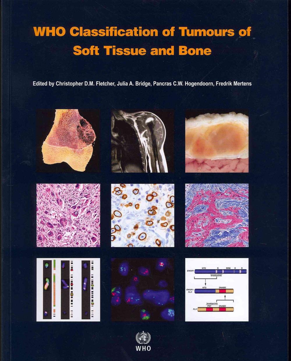 Who Classification Of Tumours Of Soft Tissue And Bone By Iarc