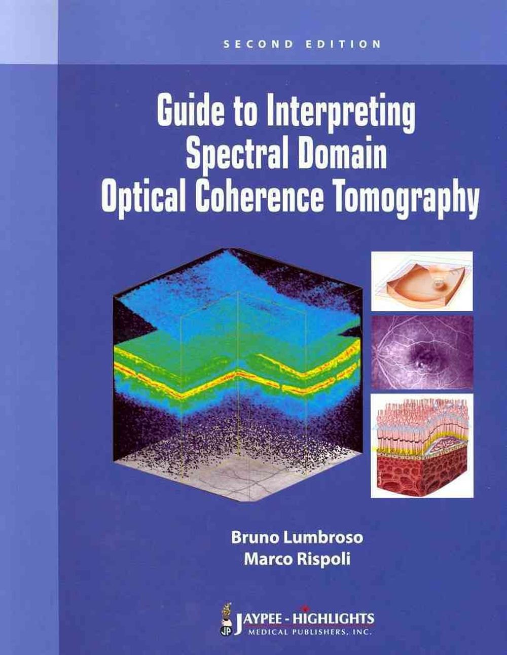Guide to Interpreting Spectral Domain Optical Coherence Tomography by ...