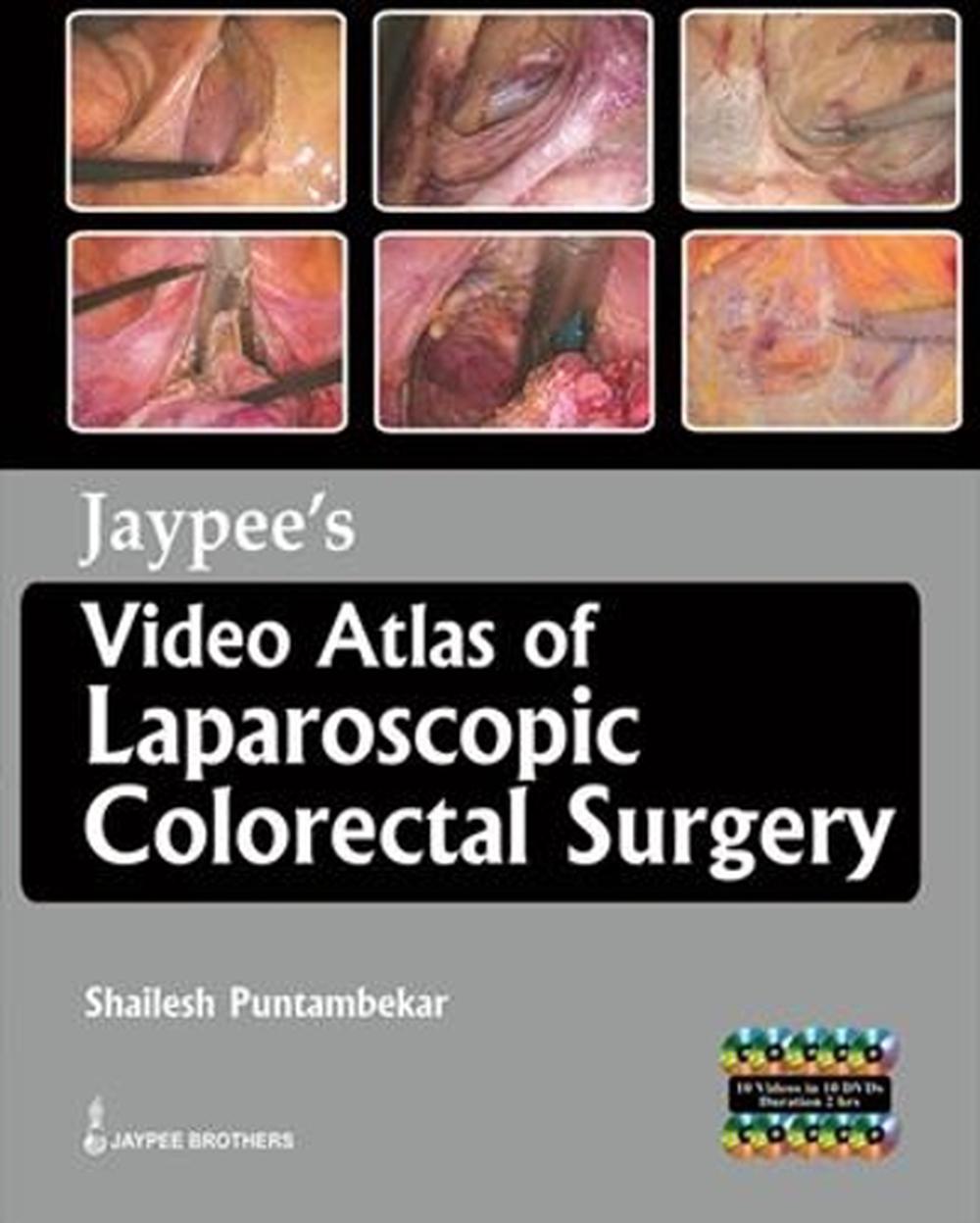 Jaypee's Video Atlas of  Laparoscopic Colorectal Surgery, 9789350258651