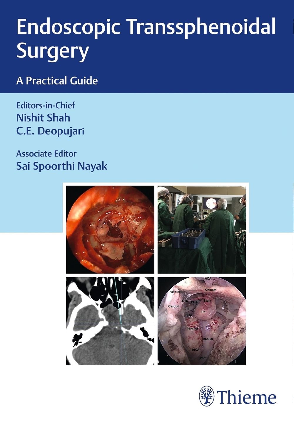 Endoscopic Transsphenoidal Surgery by Nishit Shar - ISBN: 9789388257237