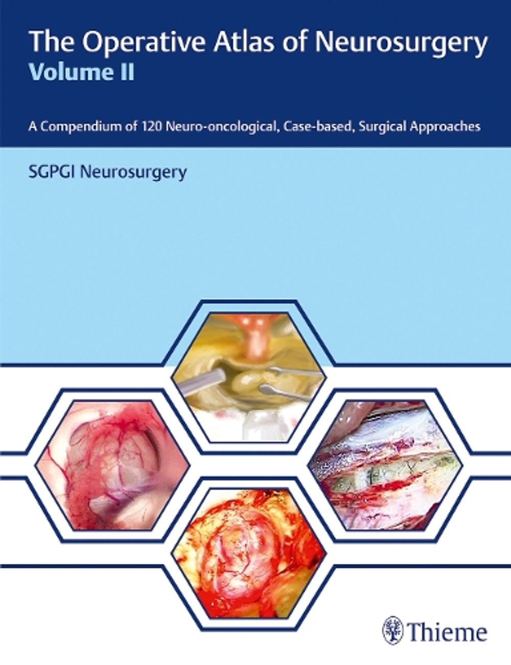 The Operative Atlas of Neurosurgery, Vol II by SGPGI Neurosurgery - ISBN: 9789388257923