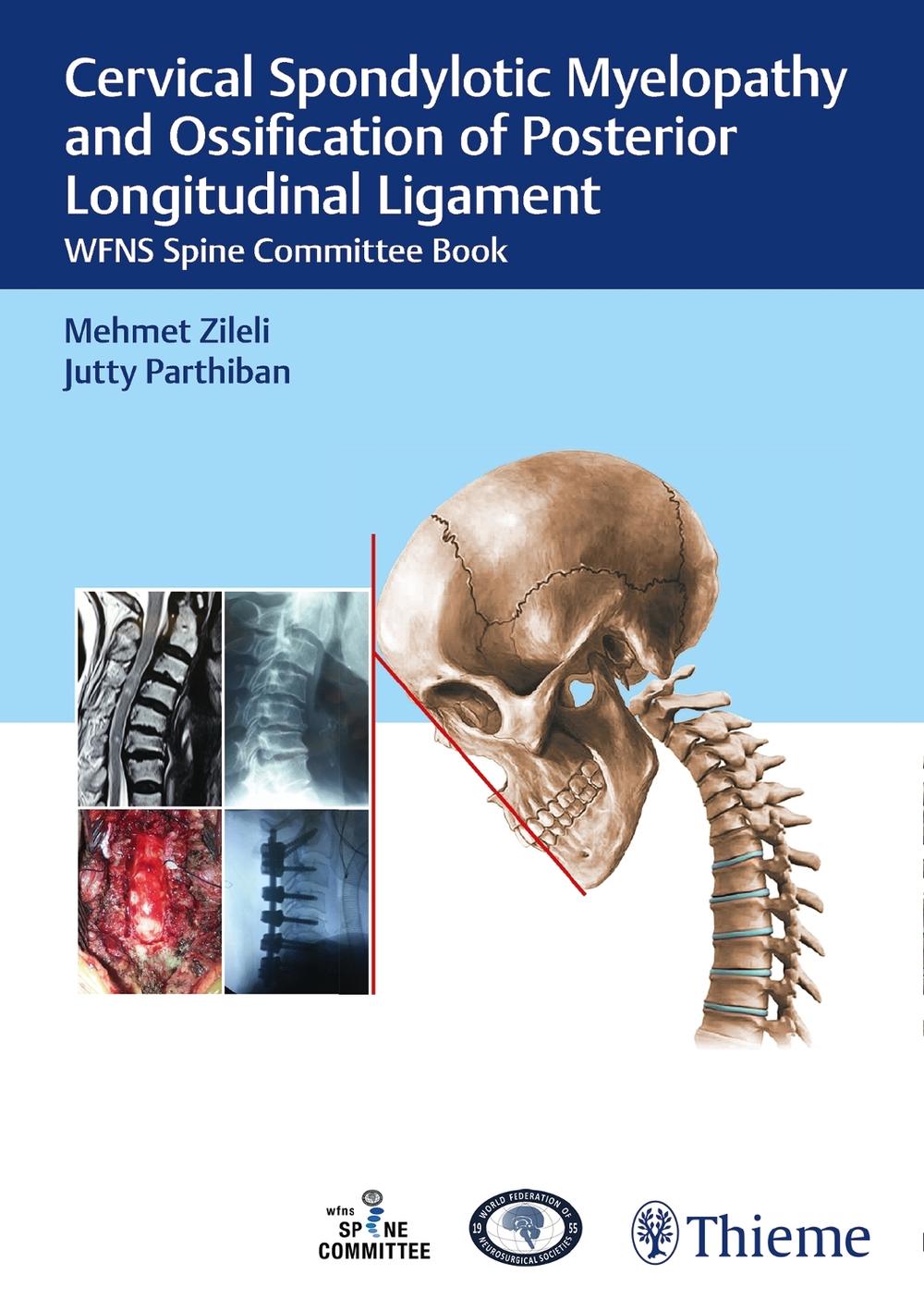Cervical Spondylotic Myelopathy and Ossification of Posterior Longitudinal Ligament by Mehmet Zileli - ISBN: 9789390553204
