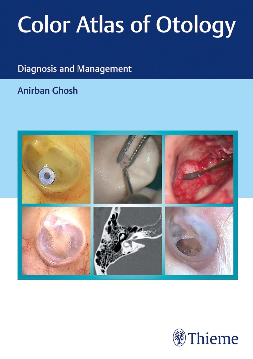 Color Atlas of Otology, 9789390553761