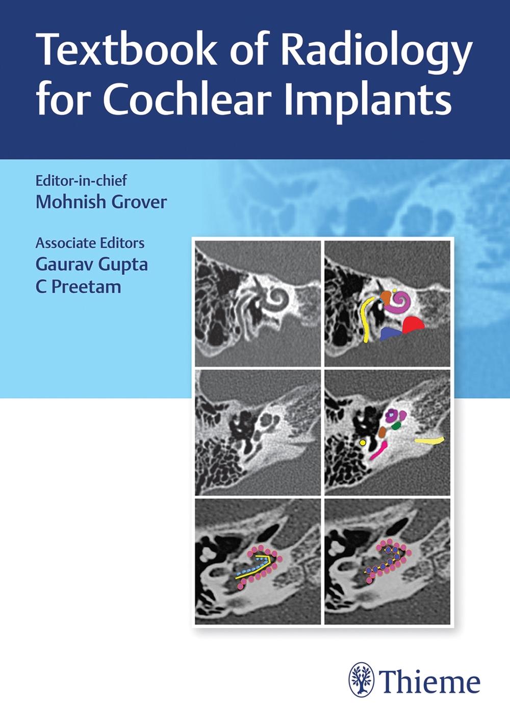 Textbook of Radiology for Cochlear Implants, 9789392819261