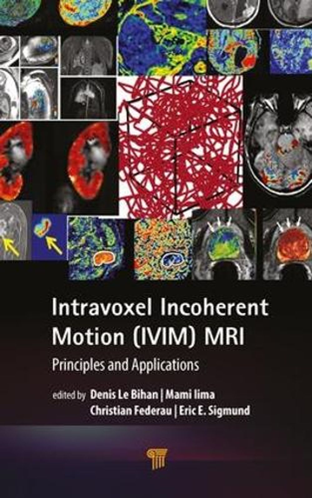 Intravoxel Incoherent Motion (IVIM) MRI by Denis Le Bihan, Hardcover ...