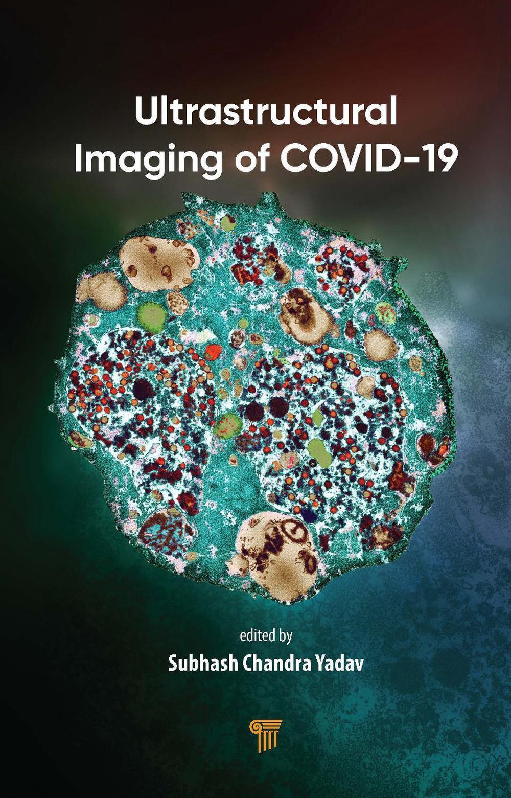 Ultrastructural Imaging of COVID-19, 9789815352009