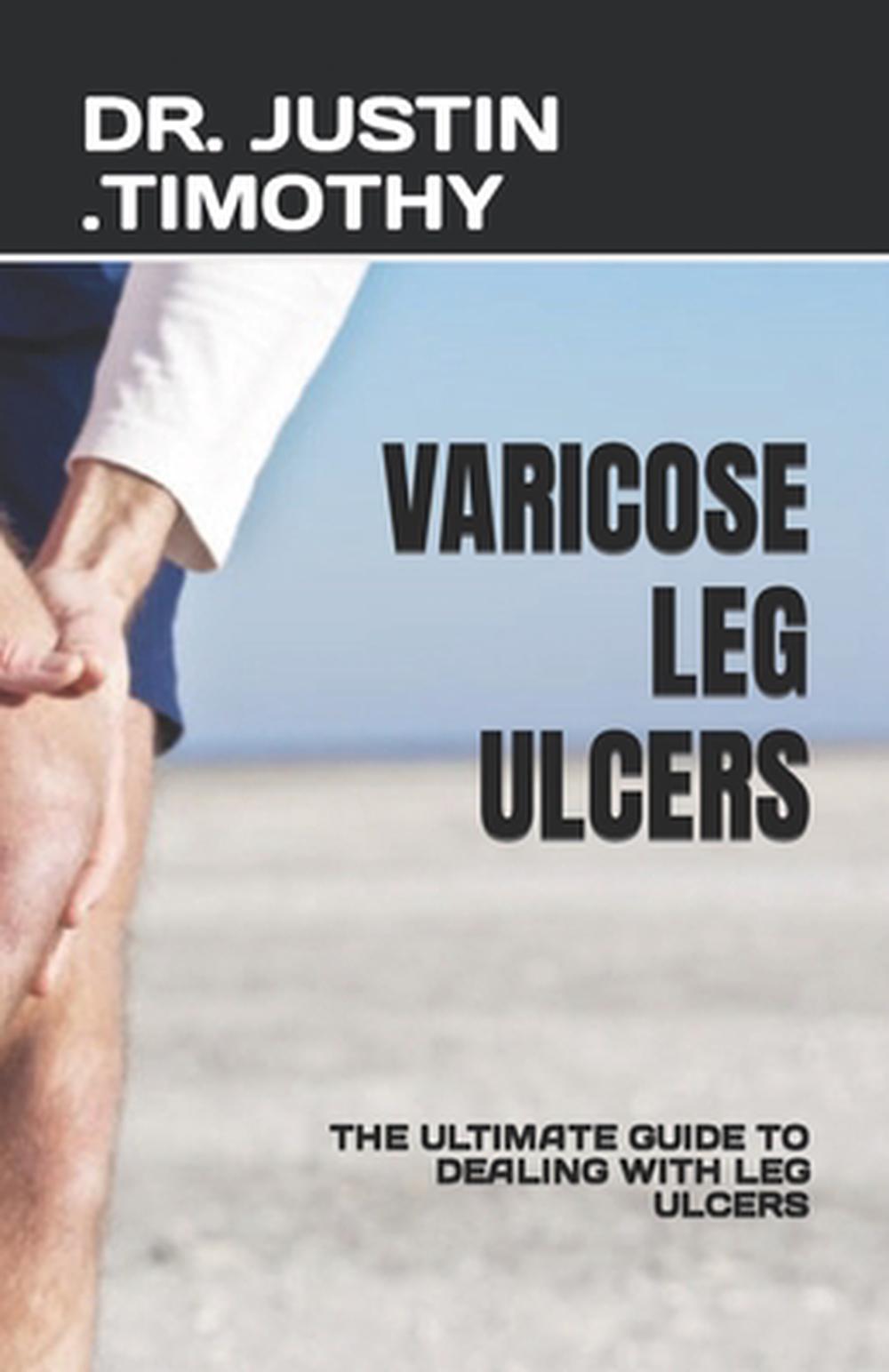 Varicose Leg Ulcers, 9798399350769