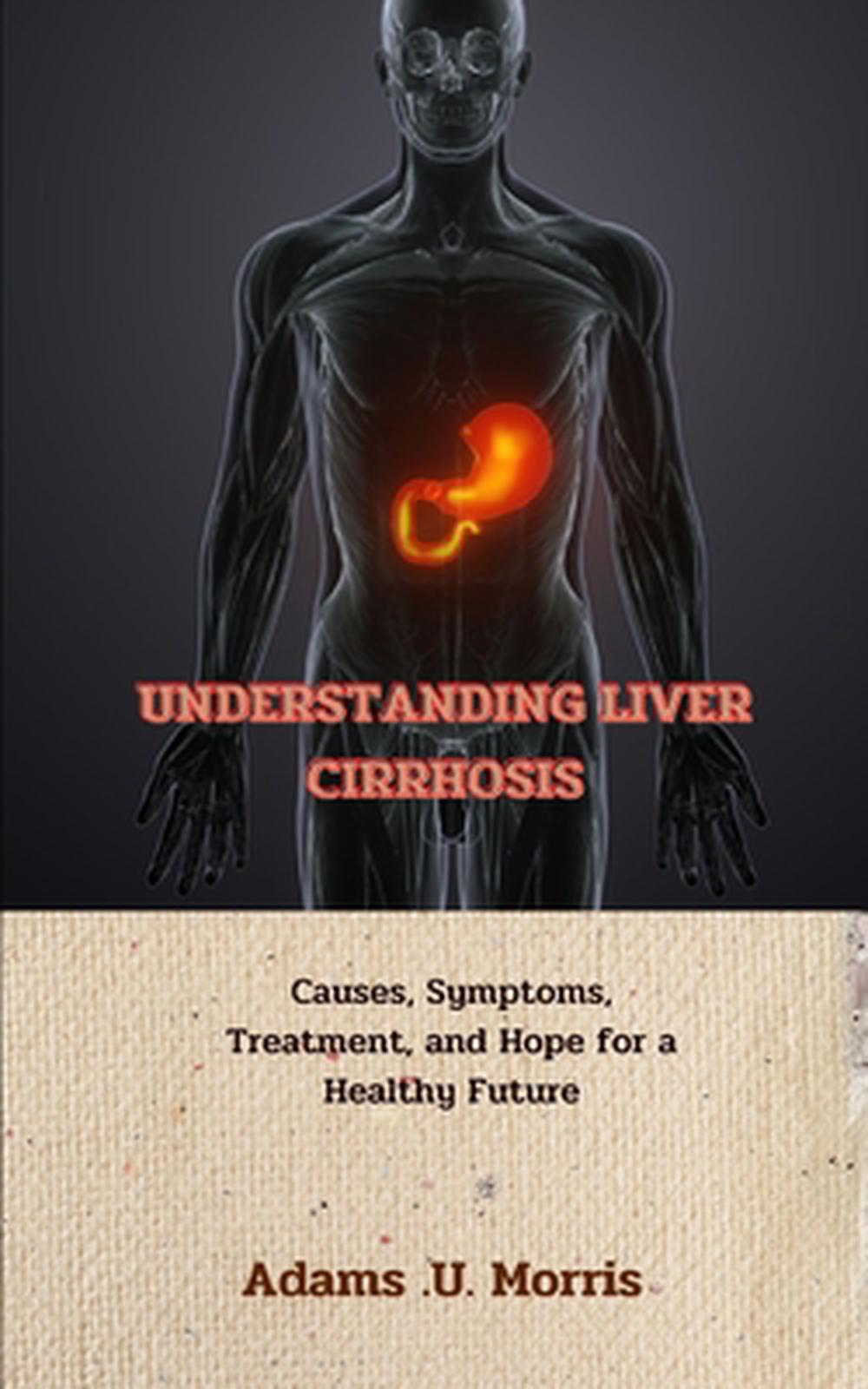 Understanding Liver Cirrhosis, 9798866459599