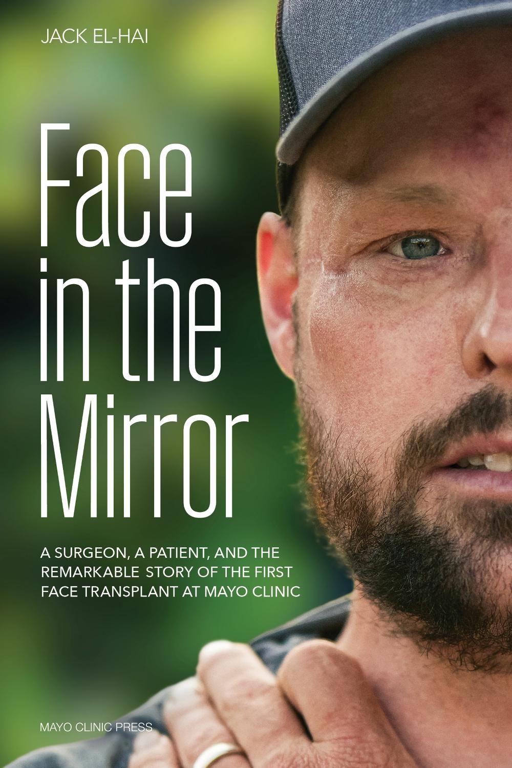 Face Transplant, 9798887700281