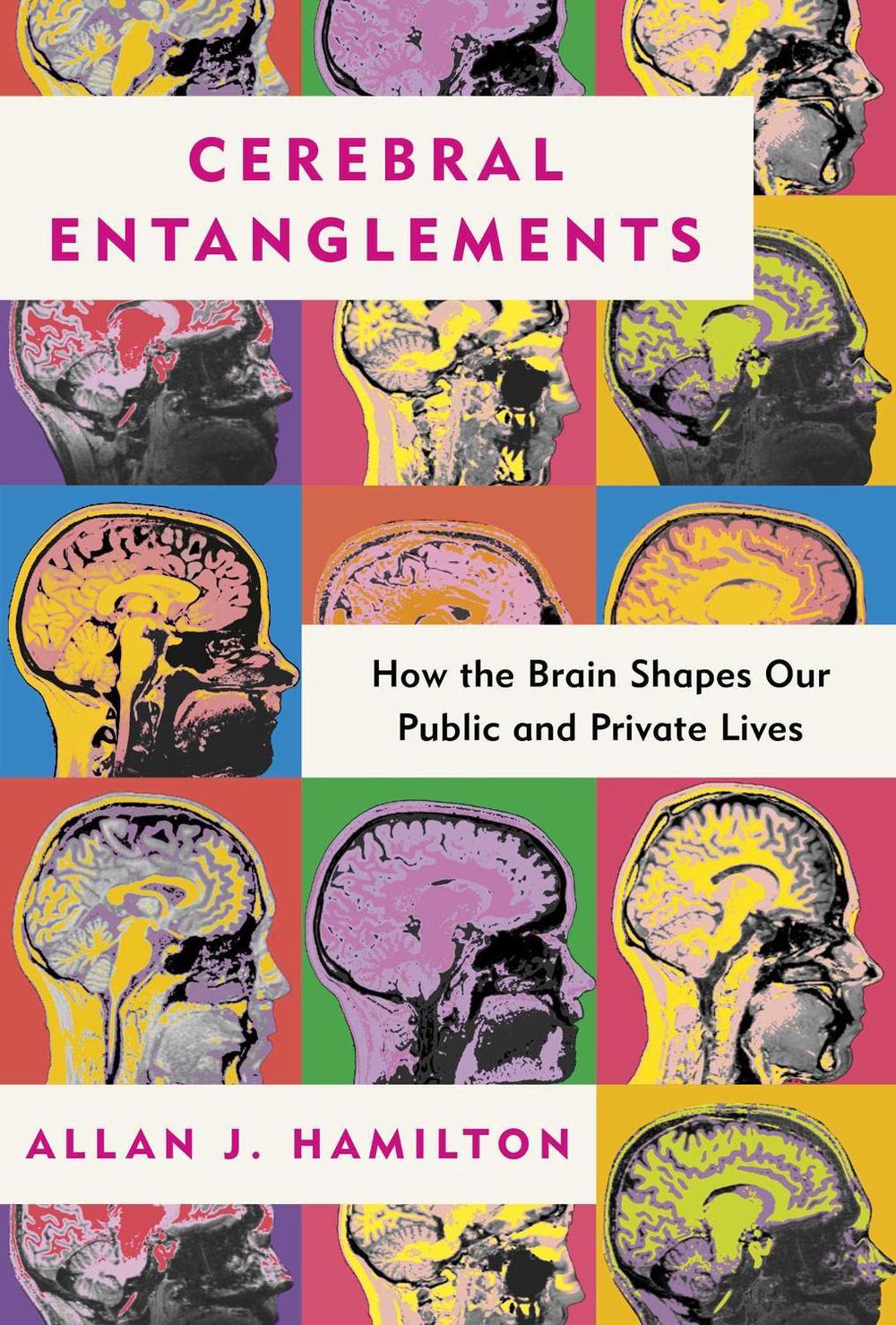 Cerebral Entanglements by Allan J. Hamilton - ISBN: 9798888459485
