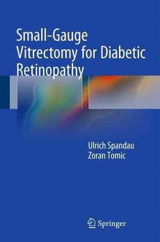 27 Gauge Vitrectomy Minimal Sclerotomies For Maximal Results By Ulrich Spandau Hardcover 9783319202358 Buy Online At Moby The Great
