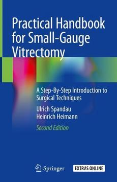 Practical Handbook For Small Gauge Vitrectomy By Ulrich Spandau Hardcover 9783319896762 Buy Online At Moby The Great